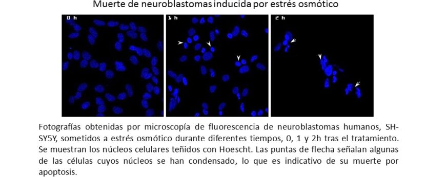 Muestran el proceso de activación de uno de los marcadores de Alzheimer